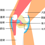 半月板損傷と診断